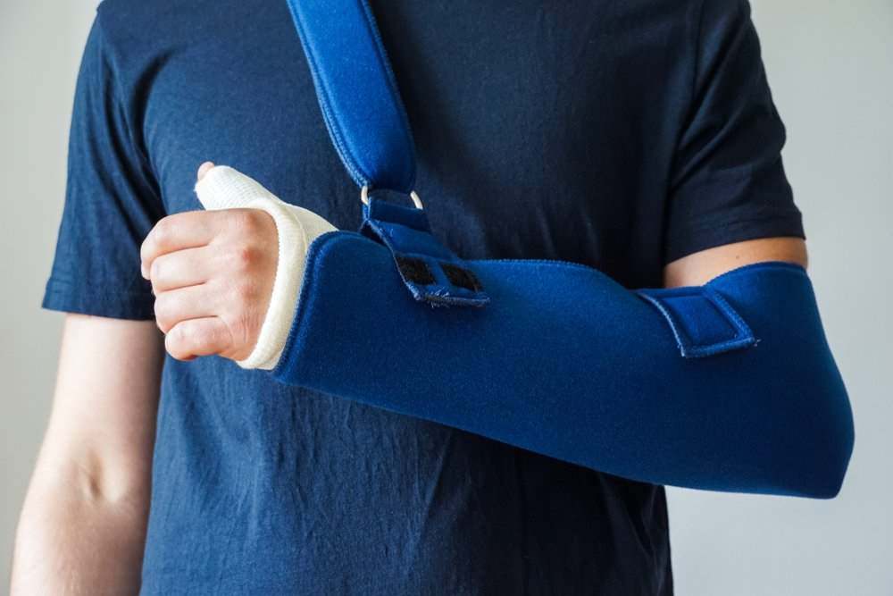 ¿Cuánto dinero puedo obtener por un brazo roto en un accidente de coche?