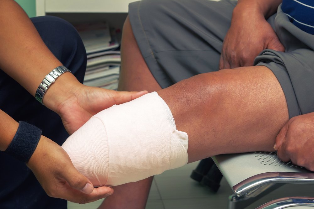 ¿Puedo Demandar por Amputación en Florida si Mi Doctor Fue el Culpable?