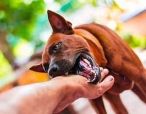 a dog biting a hand