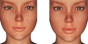 alloderm imaging