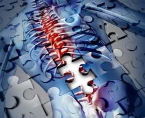 Jacksonville FL spinal cord injury lawyer