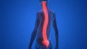 Doral FL spinal cord injury lawyer