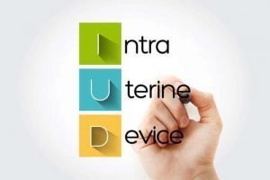 What Is the Paragard IUD Lawsuit?
