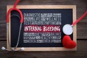 Internal Bleeding