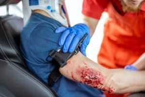 Orlando Broken Bones Car Accident Lawyer