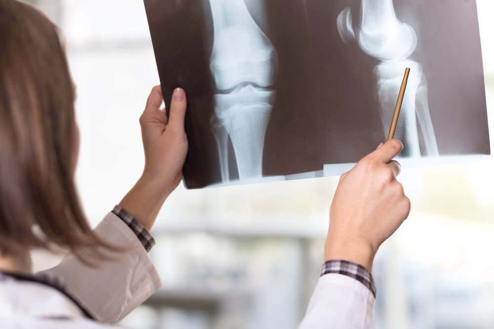 Knee Injury Lawyer in Miami No Win, No Fee. Available 24/7