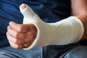 Cape Coral, FL - Broken Bones Lawyer