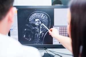 Cape Coral Traumatic Brain Injury Lawyers
