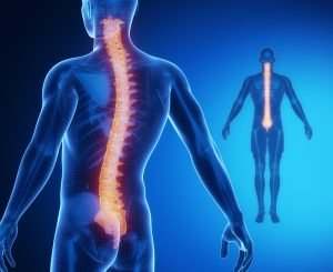 Jacksonville, FL - spinal cord injury lawyer