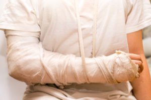 Fort Lauderdale Broken Bones Car Accident Lawyer