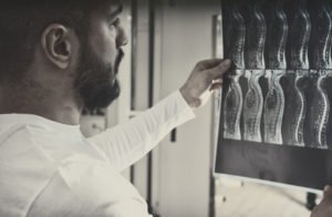 Hollywood Spinal Cord Injury Lawyers