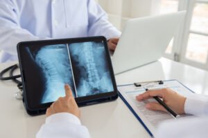 Delray Beach Herniated Disc Car Accident Lawyer