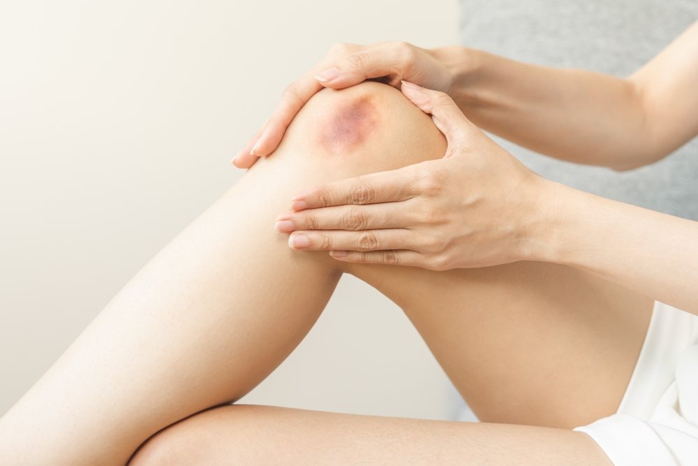 How Long Will My Tampa Slip and Fall Case Take to Resolve?