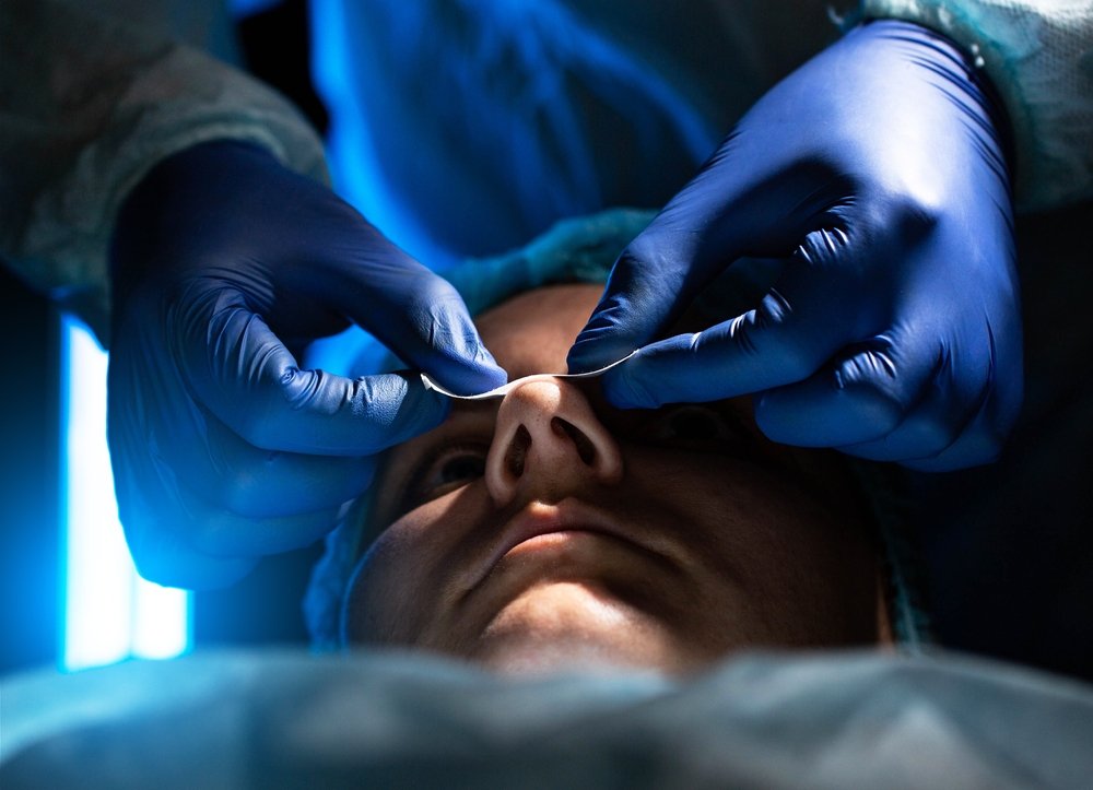 Can a Malpractice Claim Be Filed for Cosmetic Surgery Errors?