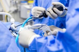 Can I Sue for Bowel Perforation in Florida if My Doctor Was at Fault?