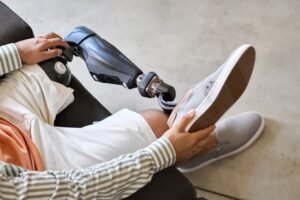 What Are the Signs That Amputation Was Caused by a Medical Mistake?
