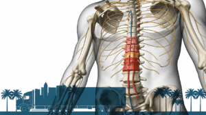 Miami Truck Accident Spinal Cord Injury Lawyer